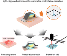 Graphical abstract: Microneedle system with light trigger for precise and programmable penetration