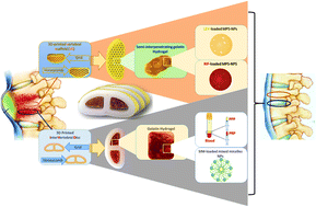 Graphical abstract: 3D-bioimplants mimicking the structure and function of spine units for the treatment of spinal tuberculosis
