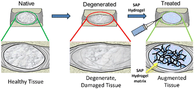 Graphical abstract: Injectable peptide-glycosaminoglycan hydrogels for soft tissue repair: in vitro assessment for nucleus augmentation