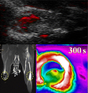 Graphical abstract: Magnetic nanoparticle-mediated non-invasive imaging and eradication of lymph nodes