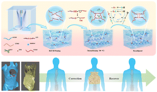 Graphical abstract: A reconfigurable, healable and recyclable 3D printed orthosis for adolescent idiopathic scoliosis