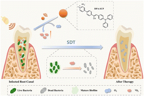 Graphical abstract: Highly effective DPA-SCP sonosensitizers for biofilm removal in infected root canals via sonodynamic therapy
