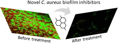 Graphical abstract: Inhibition of apoptosis and biofilm formation in Candida auris by click-synthesized triazole-bridged quinoline derivatives