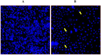 Graphical abstract: Synthesis and antiproliferative activity of 2-oxo-3-phenylquinoxaline derivatives and related compounds against colon cancer