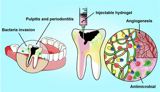 Graphical abstract: Dual-functional injectable hydrogels as antimicrobial and angiogenic therapeutics for dental pulp regeneration