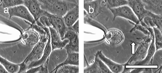 A giant vesicle containing the phosphate counterpart of 14 has
attached itself to a cluster of cancer cells. (b) The vesicle is slowly
pulled away from the cells with a micropipet. A fiber (arrow) forms between
the vesicle and cells. Bar = 20 μm.