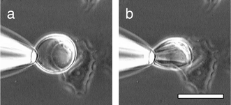 A giant vesicle containing adhesive 14 and attached to a cancer
cell showing a sphere-to-ellipsoid distortion upon application of a lateral
force. Bar = 20 μm.