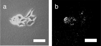 Phase contrast image of MCF-7 cells that have been incubated with
submicroscopic vesicles. The vesicles contain adhesive 14 within
their membranes and Lucifer Yellow CH in their aqueous interior. (b)
Fluorescence image of the same cluster showing fluorescence-labeled cells.
Bar = 25 μm.