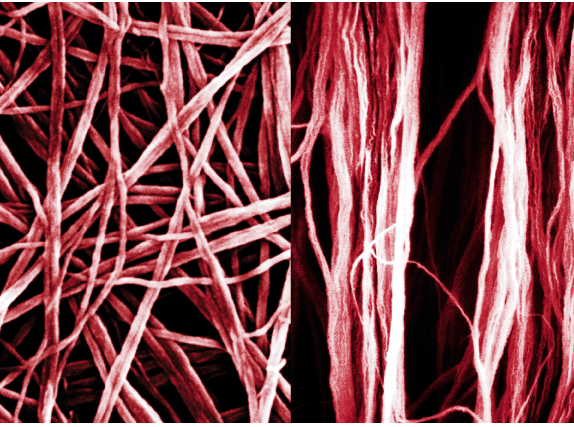  (left) A scanning electron micrograph of polyacetylene fibrils. (From K. Araya, A. Mukoh, T. Narahara, H. Shirakawa, Synth. Met., 1986, 14, 199, Fig. 3b). (right) Scanning electron micrograph of highly oriented polyacetylene fibrils synthesised by the liquid-crystal polymerisation method under a magnetic field. (From K. Akagi, S. Katayama, H. Shirakawa, K. Araya, Mukoh, T. Narahara, Synth. Met., 1987, 17, 241).