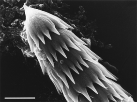 Vaterite occurs as elaborately-shaped spicules in marine animals called ascidans (scale bar 5 micrometres).