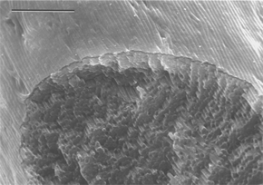 A cross-section of bacterial thread showing an internal hexagonal structure of co-aligned multicellular filaments (scale bar 10 micrometres).