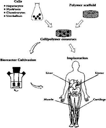 Schematic representation of the tissue engineering approach. Specific cell populations are harvested from the appropriate tissue and seeded on a biodegradable polymer scaffold. The cell–polymer constructs may undergo a period of dynamic tissue culture in a bioreactor prior to implantation. Organized structural and functional tissues may be produced in this way.7