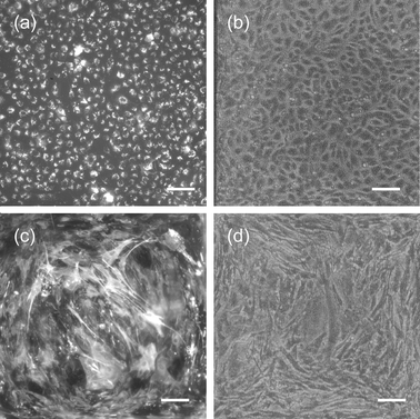 Images of endothelial and astrocyte morphology and markers on SiN membranes. (a) Fluorescent image of HUVECs showing uptake of DiI Ac-LDL . (b) Phase contrast image of HUVECs. (c) Fluorescent image of astrocytes labeled for GFAP. (d) Phase contrast image of astrocytes. Scale bar = 100 µm (a)–(d).