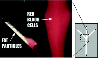 Human lipid particles separated from human erythrocytes at the trifurcation of 350 µm separation chip with ultrasound turned on.