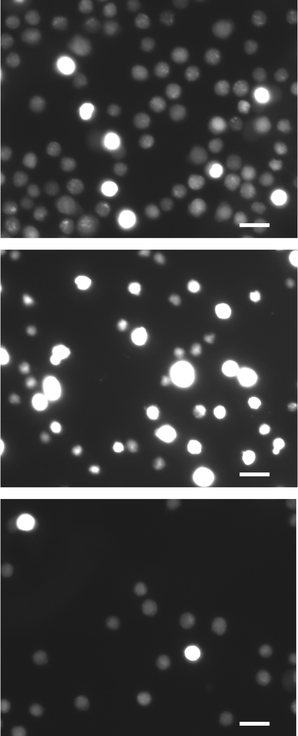 Fluorescence microscopy results (red channel: excitation maximum = 535 nm, emission maximum = 590 nm) of electroporated cells and control cells: (top) control population; (middle) cells treated at 5 kHz and 6 V; (bottom) cells treated with 10 kHz and 8.5 V. Scale bars are 15 µm.