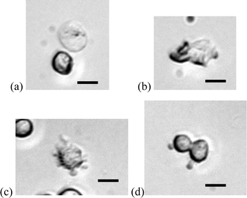 Membrane behaviour in electric field–cell interactions observed in the micro electroporation devices. Scale bars are 10 µm.