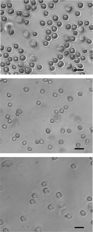 Phase-contrast microscopy of cells that were treated by electroporating conditions in comparison to the control population: (top) control population; (middle) cells treated at 5 kHz and 6 V; (bottom) cells treated at 10 kHz and 8.5 V. Scale bars are 15 µm.