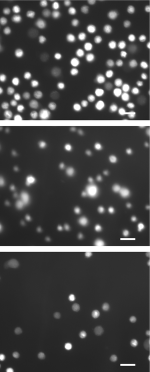 Fluorescence microscopy results (green channel: excitation maximum = 485 nm, emission maximum = 530 nm) of electroporated cells and control cells: (top) control population; (middle) cells treated at 5 kHz and 6 V; (bottom) cells treated at 10 kHz and 8.5 V. Scale bars are 15 µm.