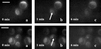 Digitized time-lapse fluorescence images of rhodamine 123 stained HeLa cell exposed to pulsed trapping beam in the presence of sodium azide. The trapped cell is marked by an arrow. (A) Fluorescence images of cells when the laser was focused on the cytoplasm: without laser exposure (a), after exposure of 1 min (b) and 6 min (c). Second row: laser focused over the nucleus: without laser (a), after exposure of 1 min (b) and 6 min (c). All images are recorded at the same magnification. Scale bar: 20 µm.