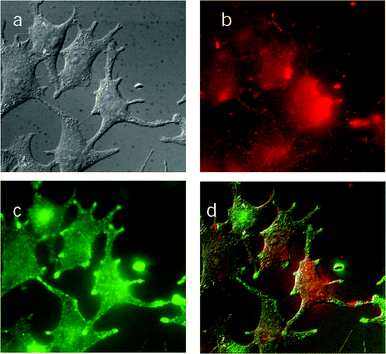 Fluorescence microscope images of B16F1 melanotic melanoma cells which had been incubated with 7 µM ZnB4Pc for 24 h. (a) Observations in a bright field; (b) fluorescence emission by the phthalocyanine (excitation at 655 nm); (c) fluorescence emission by Lucifer Yellow (excitation at 440 nm); (d) overlap of the three previous images.