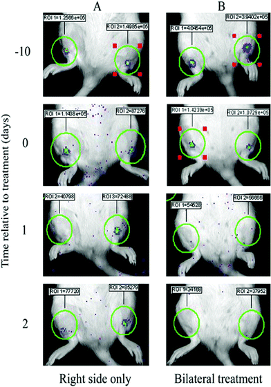 IVIS images showing examples of bioluminescent S. aureus biofilm-coated K-wires implanted into the intramedullary cavity of rat tibia before (−10 and 0 d) and after (1 and 2 d) ALA-mediated PDT to either the right side only (A) or both sides (B). The bioluminescence intensity (total flux) for each biofilm was measured within ROI of consistent size.