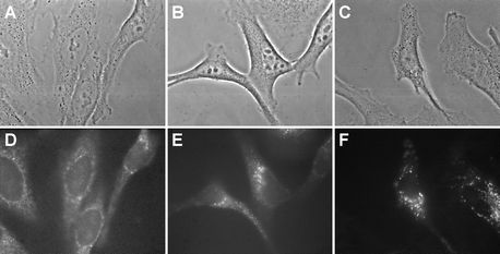 Phase contrast images (A, B, C) and fluorescence micrographs (D, E, F) obtained in NCTC 2544 keratinocytes incubated for 18 h in EMEM + 10% FCS with no additives (A, D), with 5 µM P-H (B, E) or with 5 µM P-(Lys)n (C, F). Fluorescence images were obtained with an Nikon × 100 oil immersion objective. Exposure time: 2 s. Signal attenuation: 1/16. Dichroic mirror: 400 nm. Excitation: 330–380 nm. Emission: 610–700 nm. 256 Grey levels between: −30–120 (D), −140–650 (E) and −150–2500 (F).