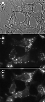 Phase contrast images (A) and fluorescence micrographs (B, C) obtained with 2544 keratinocytes incubated for 17 h with 5 µM P-(Lys)n in EMEM + 10% FCS and then for 1 h with 5 µM P-(Lys)n and 125 nM LysoTracker Green in EMEM + 10% FCS. Fluorescence images were obtained with a Nikon × 100 oil immersion objective. Exposure time: 2 s. Signal attenuation: 1/16. Dichroic mirror: 400 nm. Excitation: 330–380 nm. Emission: 610–700 nm (B) and 510–565 nm (C). 256 Grey levels between: −190–2900 (B) and −130–3100 (C).