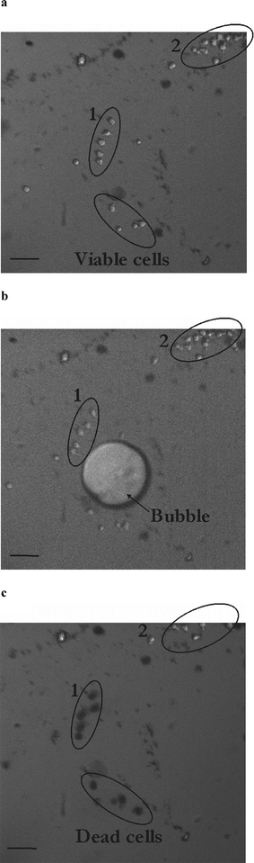 Determination of the interaction distance of a cavitation bubble with HL60 cells. Pictures of the microfluidic chamber (diameter 600 µm; height 35 µm) loaded with HL60 cells before (a), during (b) and 47 s after (c) exposure to a cavitation bubble. Black cells in (c) (group 1) have been affected by the cavitation bubble and are positive to trypan blue, whereas cells in group 2 remain viable. Scale bar denotes 50 µm.