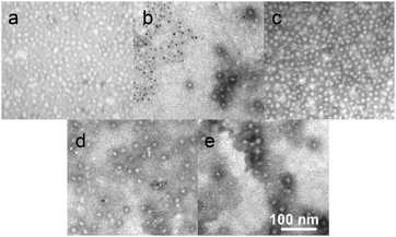 TEM images of SCKs and silver-loaded SCKs, each with negative staining by 1% phosphotungstic acid, (a) SCK, (b) AgNO3–SCK, (c) SCC10–SCK, (d) AgNO3–SCC10–SCK, and (e) SCC10–AgNO3–SCK. The scales are consistent.