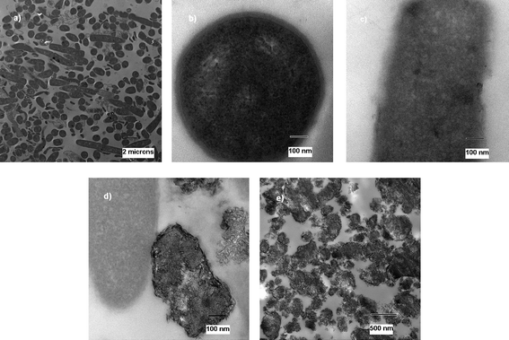 
              TEM micrograph of untreated (a and b) and treated (c, d and e) B. anthracis cells.