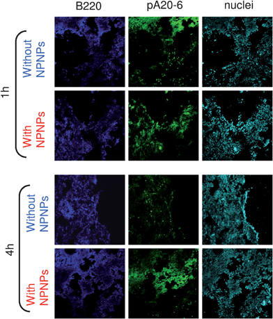 
            In vivo targeting. Histological analyses of tumor tissues in Balb/c mice treated with pA20-6 with and without the help of nanocarriers. Upper panels: 1 h after peptide injection. Bottom panels: 4 h after peptide injection. Blue channel: B220 FITC antibody revealing tumor cells. Green channel: FITC-pA20-6/NPNPs. Cyan channel: nuclei staining.