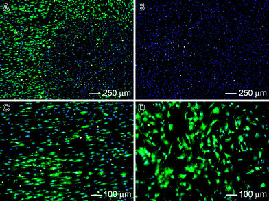 Fluorescence micrographs: (A) immunostaining of collagen type I in green and cell nucleus staining with DAPI in blue; (B) immunostaining of collagen type II in red and cell nucleus staining with DAPI in blue; and (C and D) high-magnification views of (A), illustrating immunostaining of collagen type I in green on the aligned and random portions of the scaffold.