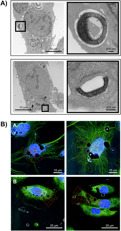 Perinuclear trafficking of hemispherical silicon particles. (A) TEM micrographs of APTES-modified silicon particles 6 h after introduction to HMVECs (top: 3.2 μm; bottom: 1.6 μm particles). (B) Confocal images of particles internalized in non-treated control (top row) or nocodazole-treated (150 nM; bottom row) HMVECs visualized with DRAQ5 (nuclei) and FITC-conjugated α-tubulin antibody, 5 h after particle addition. The localization of particles with respect to the nucleus was quantified by dividing portions of cells in quadrants, having defined distances from the nucleus.