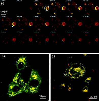 Uptake of coated nanoparticles into immortalized neuronal cells. The particles were labeled with FITC (green) and cell membranes were stained with DiA (red). Co-localization of particles in vesicles gave a yellow signal. (a) 3D optical sectioning of GT1 cells incubated for 2 h with 5S coated nanogold. The white circles in section 3 indicate coated gold nanoparticles attached to the cell surface and therefore showing only green fluorescence. The arrow in section 7 indicates membrane encircled structures filled with nanoparticles (yellow). (b) 5S nanoparticles in GT1 cells after 24 hours of incubation. (c) 5S nanoparticles in N2a cells after 2 hours of incubation.