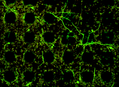 Polymer hydrogel electrodes used for evaluating the stimulation efficacy of cultured neurons. The round electrodes to the left were higher than the square electrodes on the right resulting in neurons preferentially following the circumference of the electrode as opposed to the square electrodes where processes grow on top of the electrode. Reprinted from Journal of Neuroscience Methods, 160, Nyberg et al.,40 “Ion conducting polymer microelectrodes for interfacing with neural networks”, Copyright (2007), with permission from Elsevier.