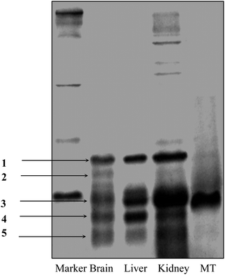 SDS-PAGE analysis of proteins in cytosol of rat brain, liver and kidney after acetonitrile precipitation. There are five lines present in brain samples: lines 1, 3, 4, and 5 coexist in brain, liver and kidney samples; line 2 is only in the brain sample.