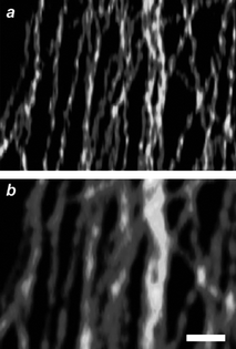 
          GSD (a) and confocal (b) images (scale bar = 500 nm) of microtubules immunolabeled with Atto 532 (reproduced from ref. 19b with permission).