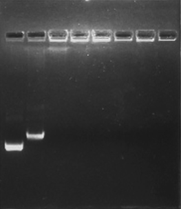 Agarose gel electrophoretic images of the HPKM/pDNA complexes: N/P ratios of 0, 1, 5, 10, 20, 30, 60, and 80 from left to right in each well.