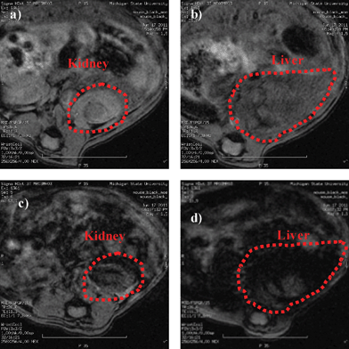 T2 weighted images of a) kidney and b) liver of a live mouse prior to injection of HA–IONPs; c) kidney and d) liver of the mouse after injection of HA–IONPs.