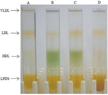 
              KBr density gradient separation of serum containing: A) no additive, B) 1-Fe, C) 1-Mn, and D) 2-Fe.