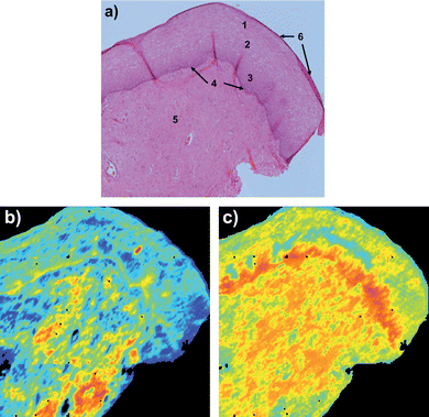 Cervical tissue section a) H&E stained section showing cellular tissue types numbered as, 1 superficial epithelial, 2 intermediate epithelial, 3 parabasal epithelial, 4 bas-al layer, 5 stroma (connective tissue) and 6 exfoliating cells; b) before RMieS correction image of amide I (1700–1575 cm−1) band intensity (colours red to blue corresponding to high to low absorbance respectively); c) after RMieS correction image of amide I band (same scale as b)).