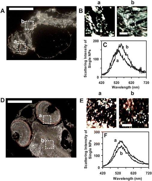 Quantitative imaging and characterization of individual Ag NPs embedded in the tissues of (A–C) deformed zebrafish and (D–F) normal zebrafish using DFOMS-MSIS. Optical image of ultrathin longitudinal section of fixed (A) deformed zebrafish with five types of deformities; and (D) normal zebrafish. (a) Eye and (b) brain tissues are squared in (A) and (D). (B) and (E): zoom-in optical images of the tissue sections of (a) and (b) as highlighted in (A) and (D) show single Ag NPs embedded in the tissues, respectively. (C) and (F): LSPR spectra of the individual Ag NPs circled in (B) and (E) show distinctive λmax (FWHM) of (C): (a) 556 (97); (b) 549 (104) nm; and (F): (a) 552 (89); (b) 554 (109), respectively. The scale bars are 500 μm in (A) and (D) and 50 μm in (B) and (E).