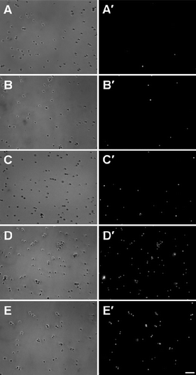 
          Membrane integrity assay. Conidia treated with 100 mM of alkyltributylphosphonium chlorides, [P4 4 4 n]Cl (n = 1, 4, 8 or 12), during one hour of incubation, and stained with propidium iodide, PI. Left column (A–E) shows totality of conidia in the differential interference contrast (DIC); right column shows PI-stained conidia (A′–E′). Observed fluorescence indicates membrane-damaged conidia in: (A, A′) saline solution control; (B, B′) n = 1; (C, C′) n = 4; (D, D′) n = 8 and (E, E′) n = 12. Scale bar (E′): 20 μm.