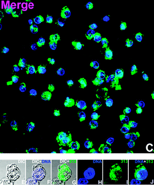 Cell imaging with hydroxymethyl complex 5 (overlaid 5 green Hoechst Blue) (further data in the ESI).