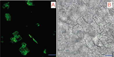 Confocal (A) and bright field (B) microscope images of drug loaded gels. Scale was 10 μm.