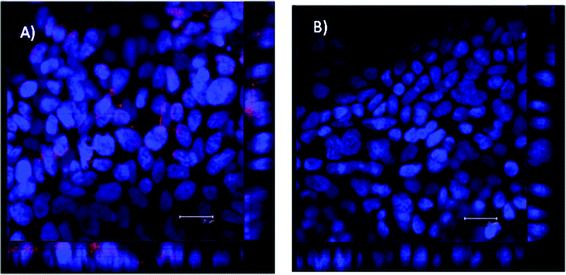 Confocal micrographs showing immunostaining for folate receptor (FOLR1) in filter-cultured Calu-3 cell layers. Cells were incubated with mouse, anti-human FOLR1 primary antibody and goat, anti-mouse TRITC (red)-labelled secondary antibodies (A). Calu-3 cell layer incubated with only goat, anti-mouse TRITC-labelled secondary antibody (control) (B). The image of the vertical (‘z-axis’) is shown on the bottom and the right side of the image. Scale bar = 20 μm.