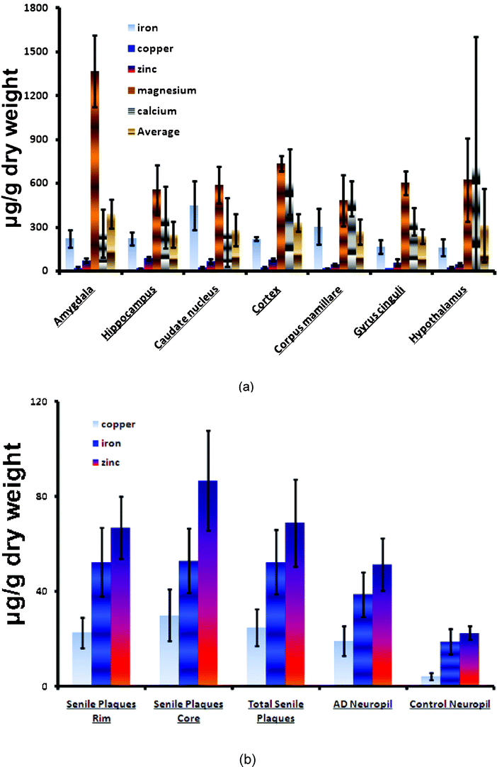 (a) Case series data and results of the analysis of various metals in postmortem human normal brains; (b) case data and results of copper, iron, and zinc concentrations in various plaque-related measures in AD subjects and in neuropil in both AD and normal subjects.174,178–180