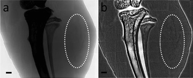 (a) and (b) are projection views of photoluminescent MUA-AuNPs loaded in EMT-6 cells that developed tumors; the MUA-AuNPs could also be viewed by X-ray imaging. (b) was processed by background flattening.