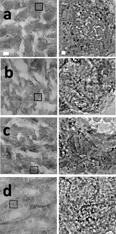 High resolution X-ray micrographs of MUA-AuNPs in different tissues: (a) liver, (b) lung, (c) spleen and (d) tumor. The figures on the right-hand side are magnified versions of the marked boxes of the left images.