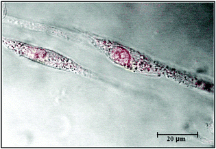 U87 cells uptake of Au-thymine NPs after 1h: image obtained by confocal microscopy. The image was red coloured for clarity.